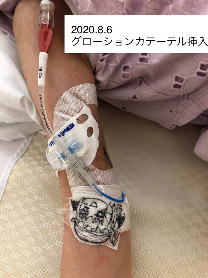 難治性腹水　訪問看護　医ケア児