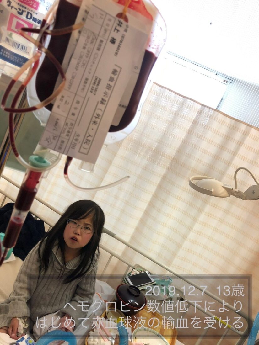 難治性腹水　訪問看護　医ケア児