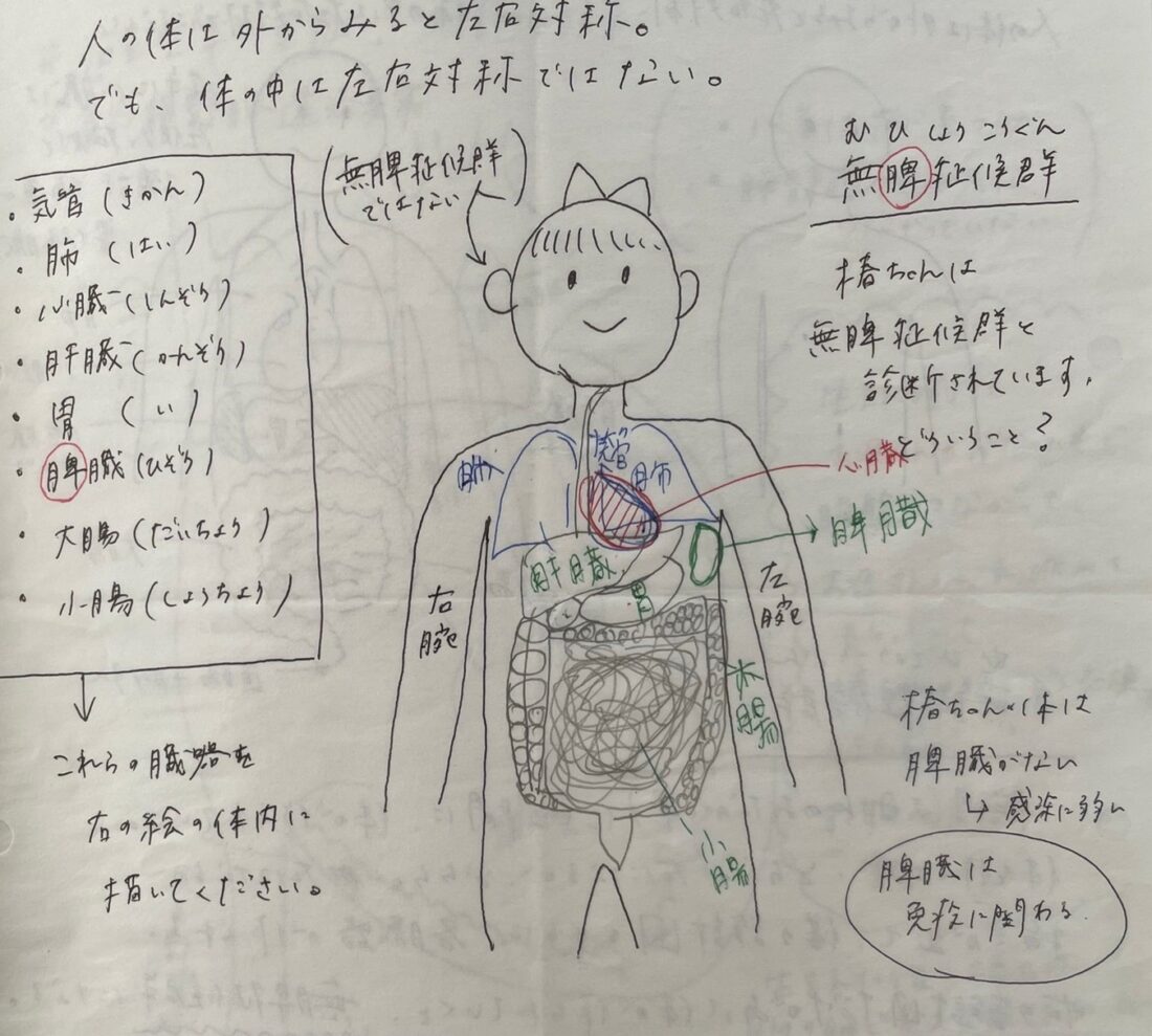 難治性腹水　発達障害　医療的ケア児